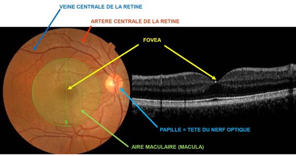 macula